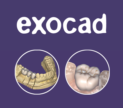 Exocad<br>CHAMPIONS-Implants ist exocad-Reseller
